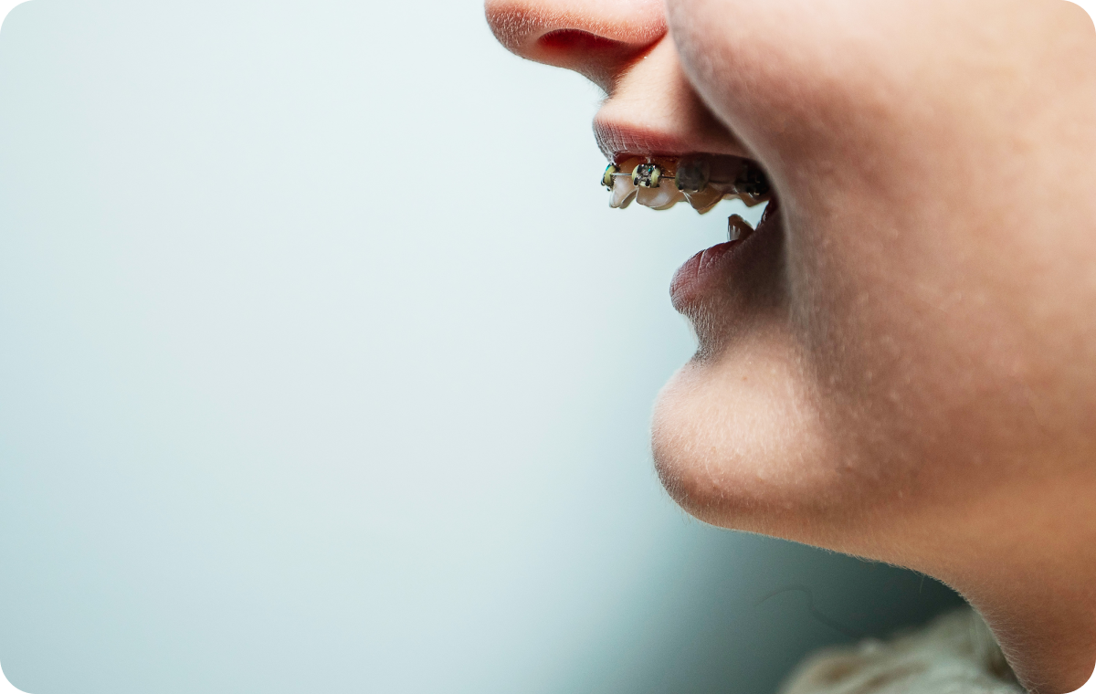 adobestock_677900925