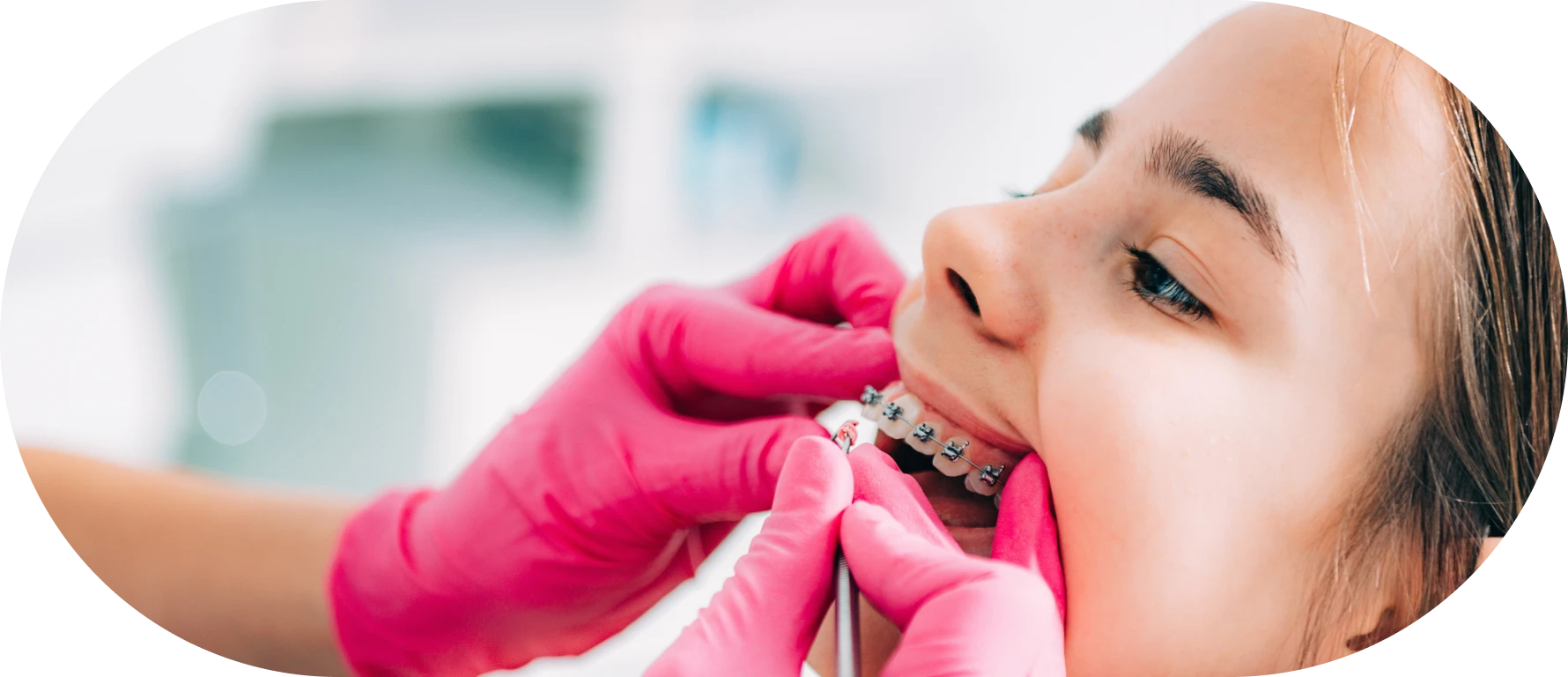 multi_bagues_adolescents (1)